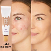 Light-medium